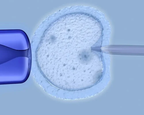 Rosi Tekniği Nedir? Kimlere Yapılır?