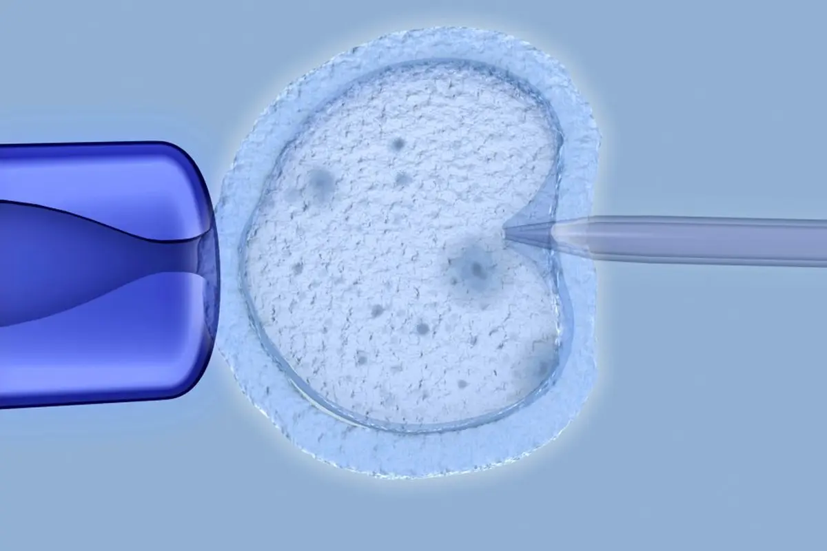 Rosi Tekniği Nedir? Kimlere Yapılır?