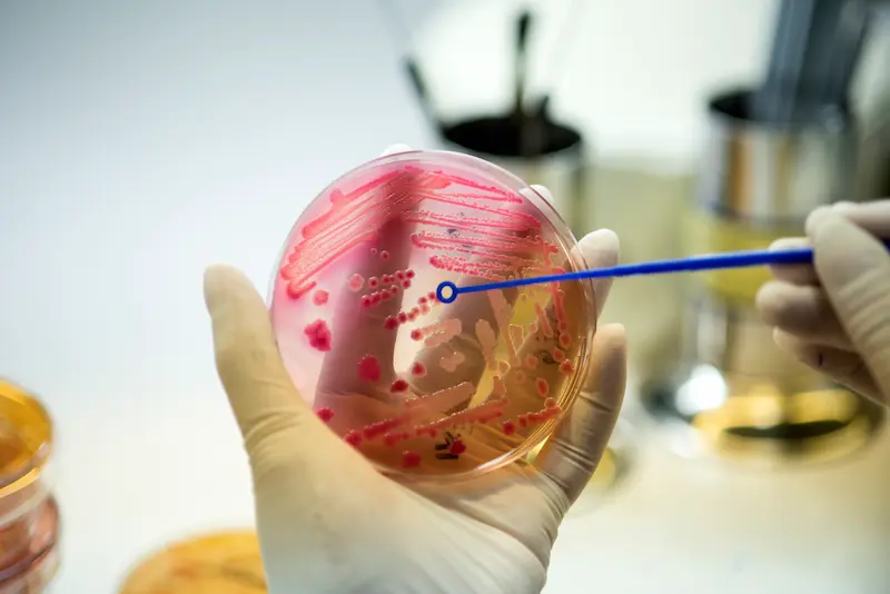 Azospermi Ne Anlama Gelir